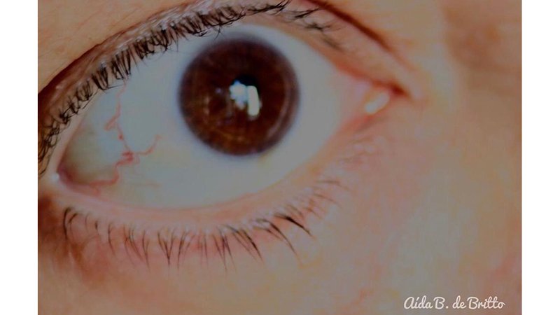 Foto: Aída B. Britto